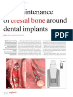 Crestal Bone: The Maintenance of Around Dental Implants