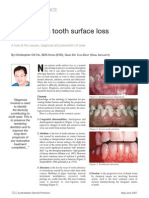 Non Carious Tooth Surface Loss