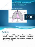 Efusi Pleura Ppt 