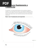 Como Curar Rapidamente a Conjuntivite
