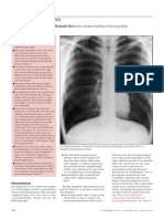 cxr easy 3