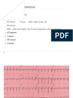 ECG Interpretation: RR Interval Heart Rate