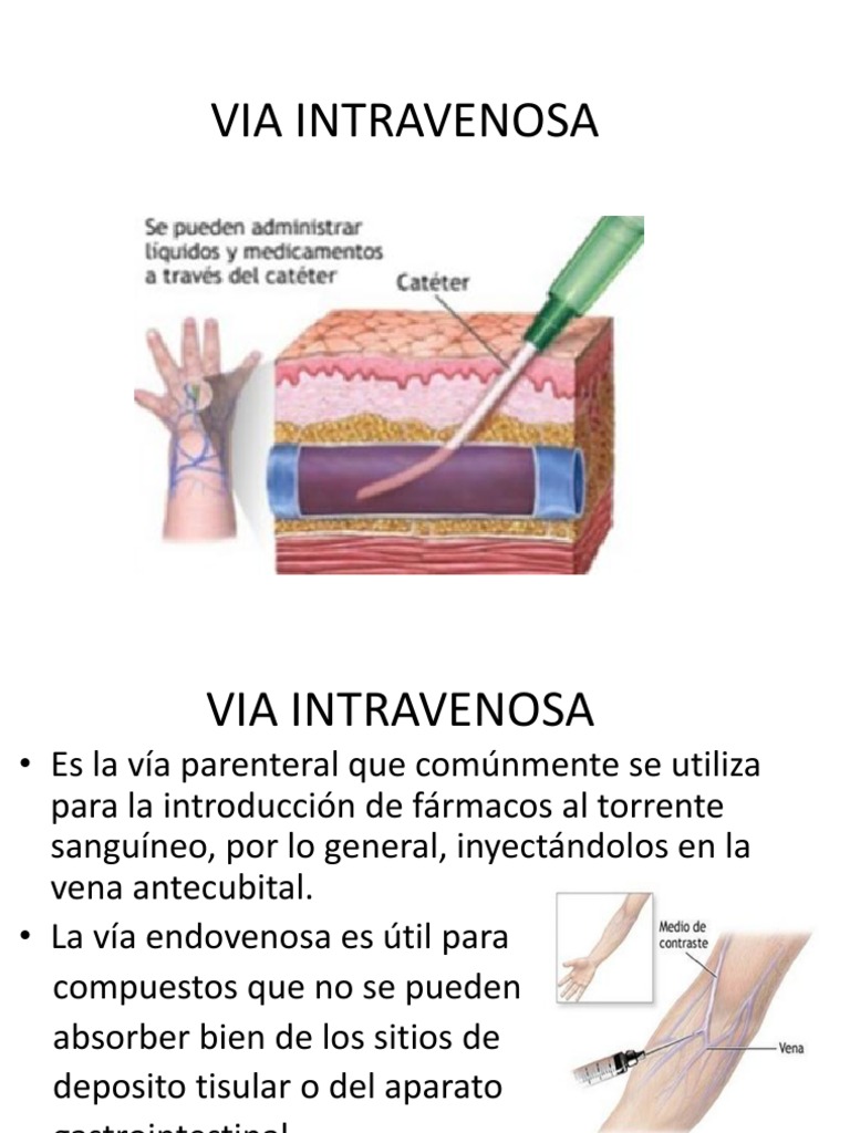 Via Intravenosa Terapia intravenosa Tratamientos médicos