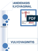 Candidiasis Vulvulo Vaginal