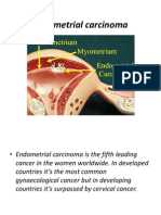 Endometrial Carcinoma