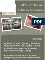 Impaksi Molar