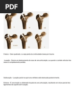 Tipos de Fraturas