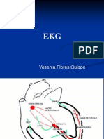 Electrocardiogram A