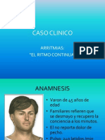 Caso Clinico Arritmias