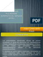 Enfermedad Pulmonar Intersticial Difusa (Epid)