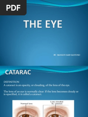 THE EYE