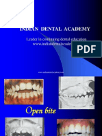 Open Bite Sem (Recovered) / Orthodontic Courses by Indian Dental Academy