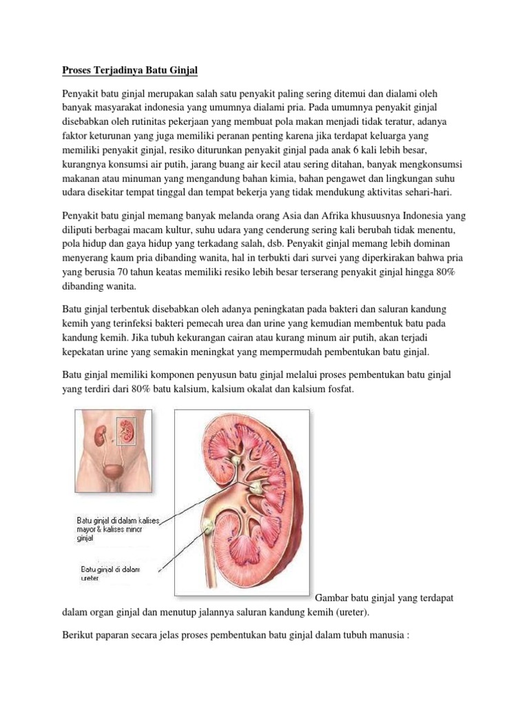 Proses Terjadinya Batu Ginjal