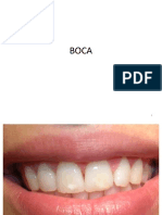 Boca