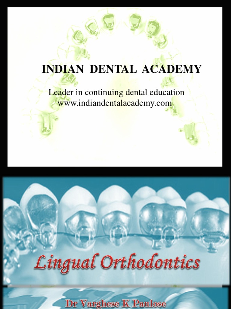 Lingual Orthodontics / orthodontic courses by Indian dental academy Dentistry Human Head And