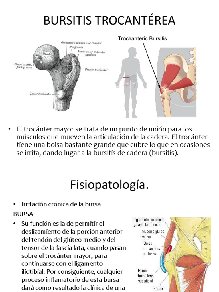 Bursitistrocantrea 120425235721 Phpapp02 | PDF | Rodilla | Medicina, image size:768x1024