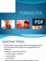 Tonsilitis