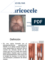 Varicocele