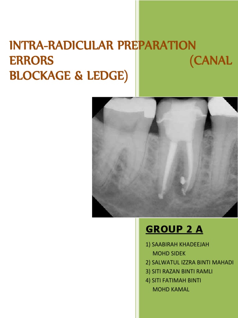 Managing Canal Blockage and Ledge Formation | PDF | Dentistry Branches ...