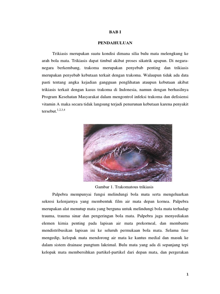 Trikiasis: Penyebab dan Penanganan Kelainan Palpebra | PDF