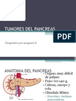 tumores pancreaticos