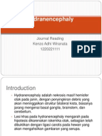 Journal Reading Hydranencephali