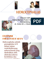 Power Point Hidrocephalus