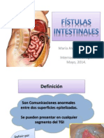 Fístulas Intestinales