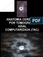 Anatomia Cerebral Por Tomografia Axial