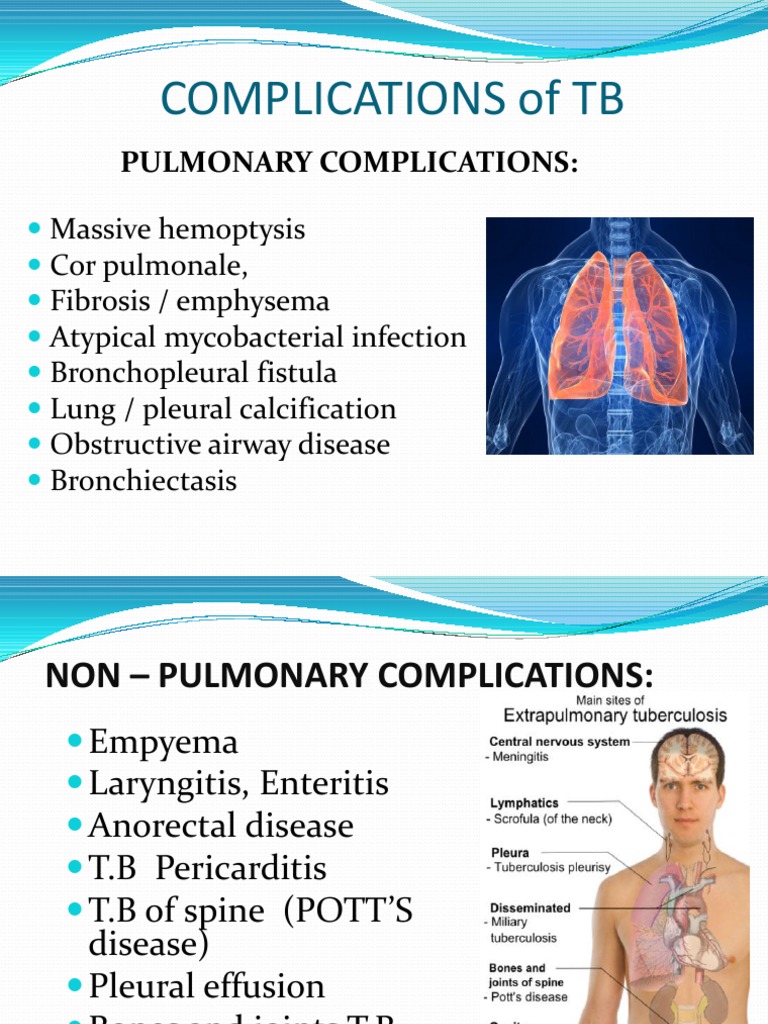 Treatment of Tuberculosis | PDF | Tuberculosis | Animal Diseases