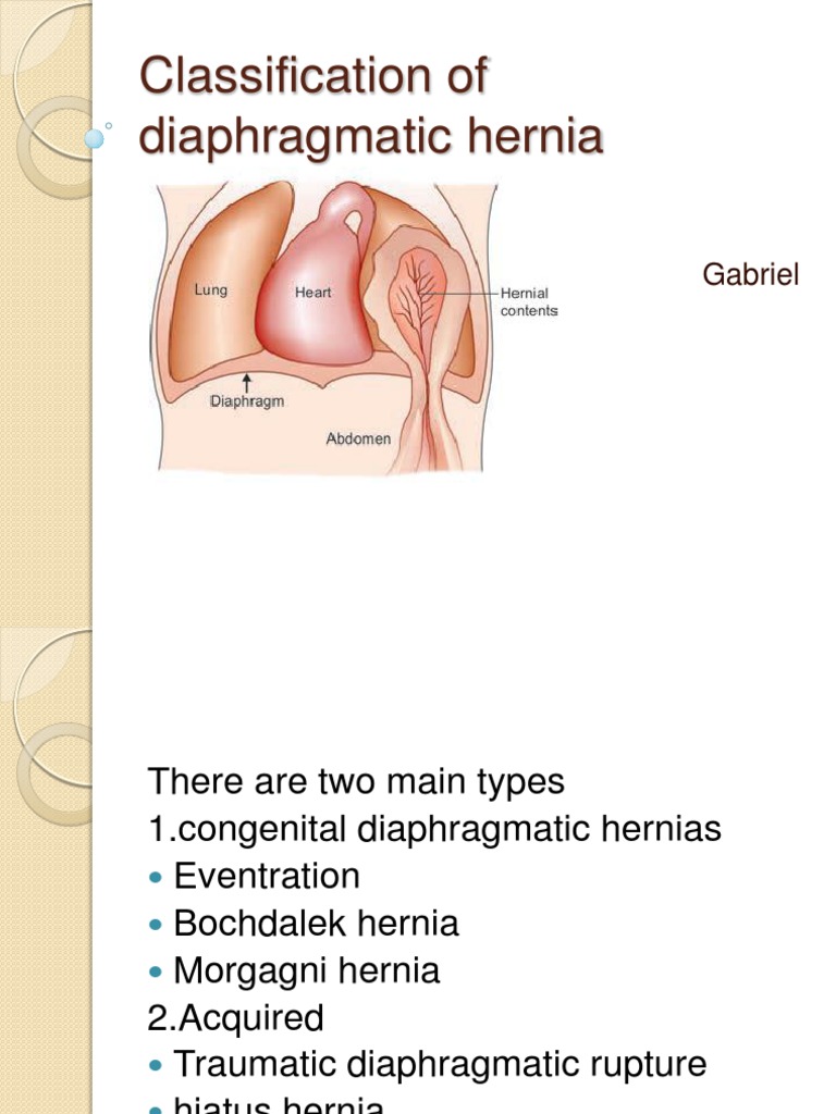Diaphragmatic Hernias | PDF | Medical Specialties | Gastroenterology, image size:768x1024