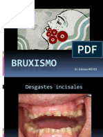 BRUXISMO