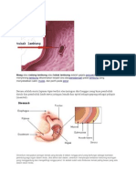 Tukak Lambung