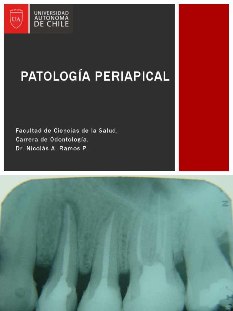 Clase 05 PO Patologia Periapical I PDF Inflamación Inmunología