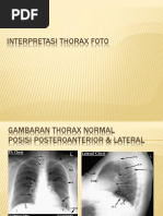 Download Interpretasi Thorax Foto by Elfha Monita SN225735726 doc pdf