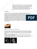 Ganglia Are Most Commonly Located Around The Wrist As A Soft Tissue Swelling With A Pedicle