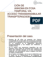 Remoción de schwannoma vía acceso transpterigoideo