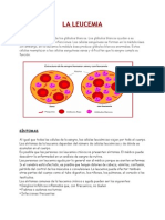 LEUCEMIA