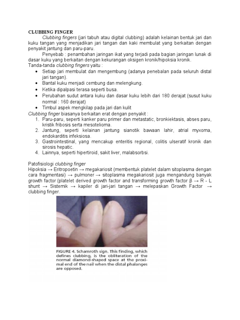 Penyebab dan Tanda Clubbing Fingers | PDF