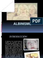 Albinism o