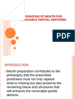 Preparation of Mouth for Removable Partial Dentures 