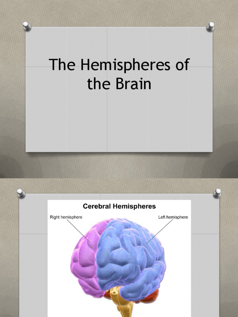 The Hemispheres of The Brain | PDF | Lateralization Of Brain Function ...