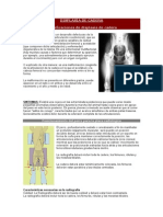 Displasia de Cadera PDF