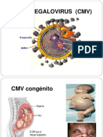 Citomegalovirus (CMV)