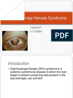 Vogt Koyanagi Harada Syndrome