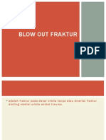 BLOW-OUT FRACTURE