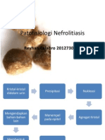 Patofisiologi Nefrolitiasis