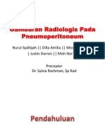 Gambaran Radiologis Pada Pneumoperitoneum