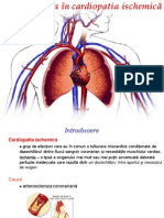  Kinetoterapia in Cardiopatia Ischemica