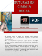 Suturas en Cirugia Bucal